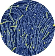 Bacillus Koagulan